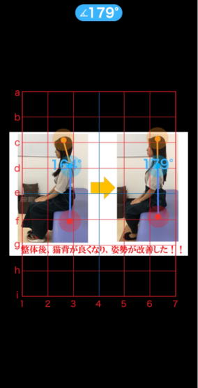 横浜鶴見の整体院「指楽」でブライダル整体を受けた患者様�@AI姿勢分析