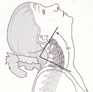 頸椎の伸展のイラスト